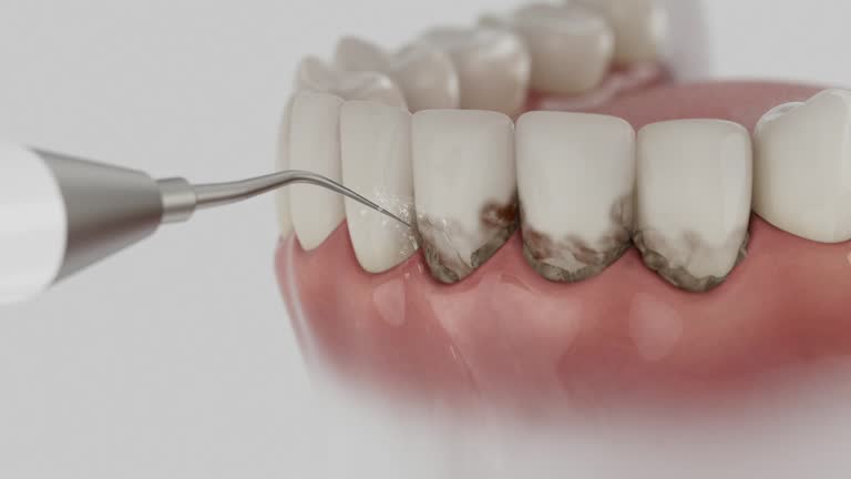 Reliable Root Canal Treatment contractor in Lee County County, NC by Dentist Open Now